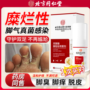 糜烂性脚气喷雾止痒脱皮杀菌型脚趾缝烂脚丫真菌感染药房同售WQ