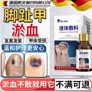 脚趾甲被砸指甲被夹压受损瘀血发黑甲床受伤甲下淤血发紫生长液HT