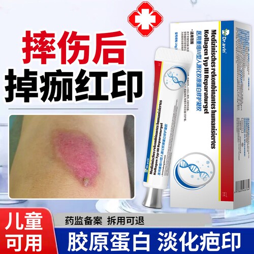 掉痂后红印修复擦伤摔疤痕