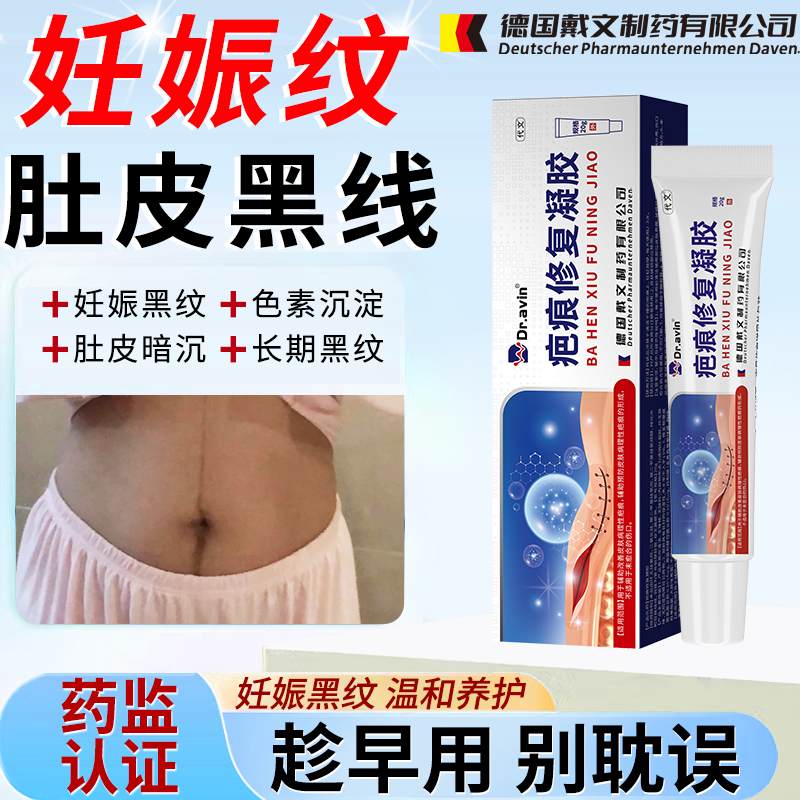 产后肚子黑色素沉淀去线祛