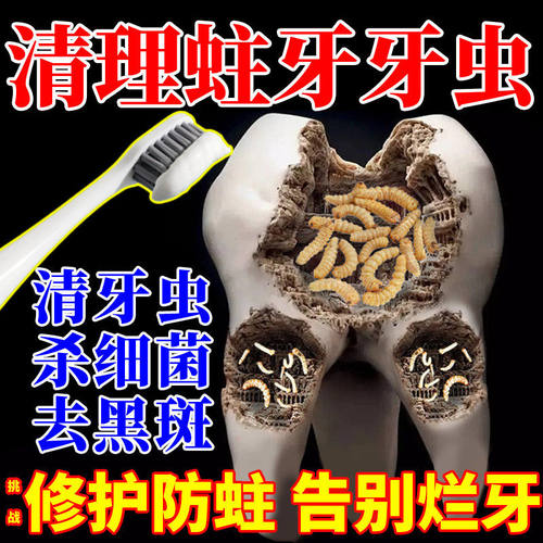 牙膏防蛀抗敏含氟成人龈护