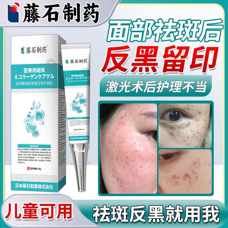 激光祛斑后反黑修复脸上黑斑去疤印去黑色素沉淀分解医用型除膏VQ