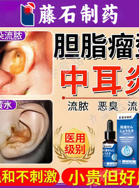胆脂瘤型中耳炎滴液朵流黄