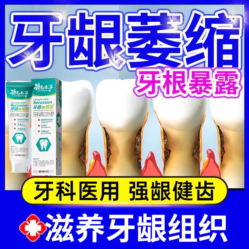 云南本草牙膏牙周炎口腔牙龈委缩牙龈出血专用消炎止痛厂家直销