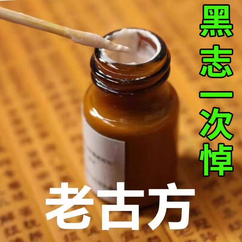 点黑痣膏无痕脸部点痦子取痣去黑痣专用典痣药水神器仪黑点去