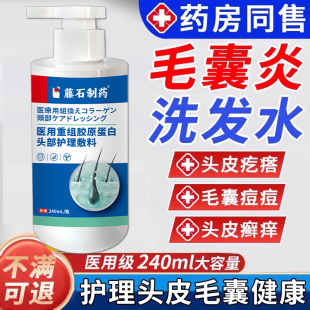 头皮毛囊炎洗发水头发头痒有疙瘩喷雾剂头癣专用脂溢性皮炎WQ