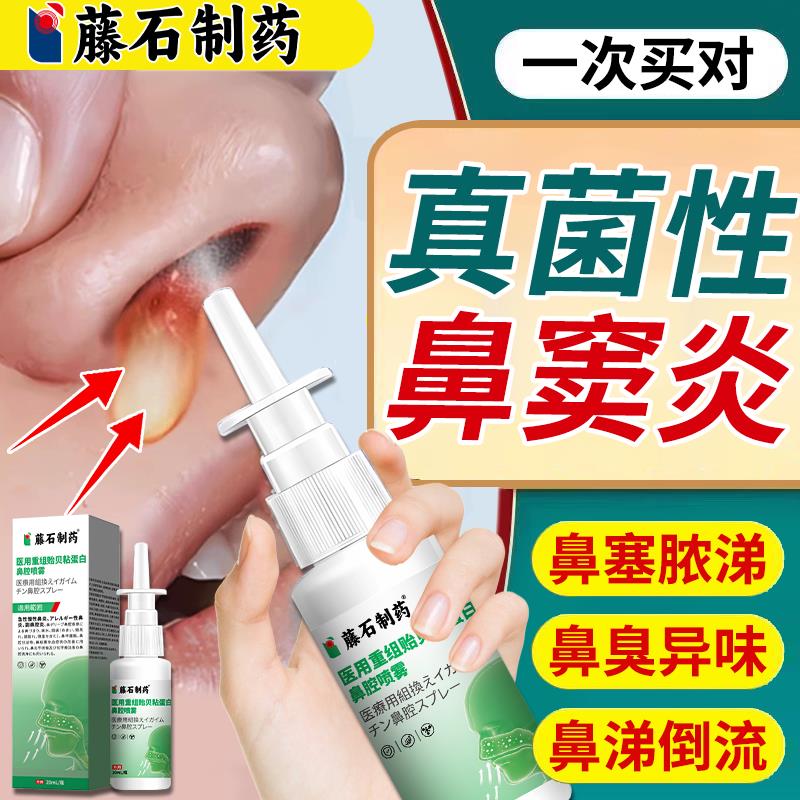 真菌性鼻窦炎排脓喷雾剂细