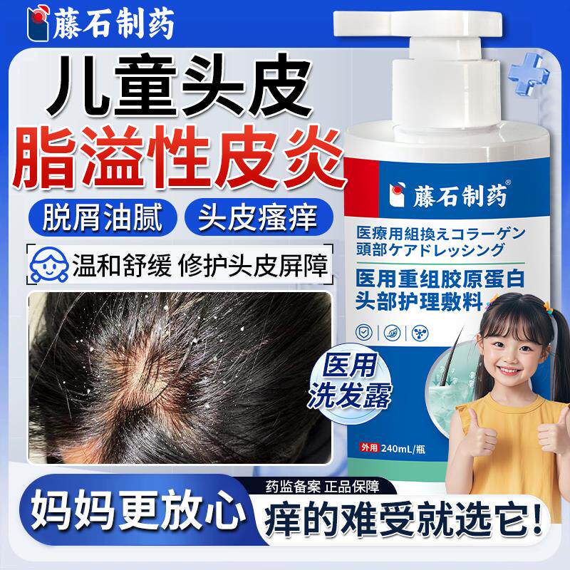 儿童脂溢性皮炎真菌感染头癣毛囊炎头皮屑专用洗发水马拉色菌XY
