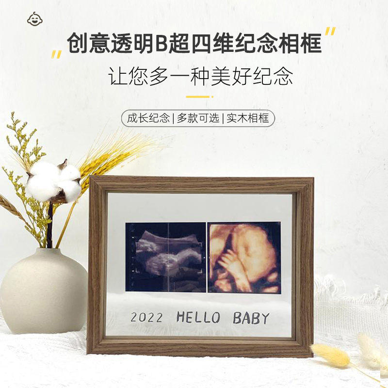 mengbaby宝宝满月百日手足印纪念品一周岁脚印四维b超图孕期相框 玩具/童车/益智/积木/模型 手脚印 原图主图