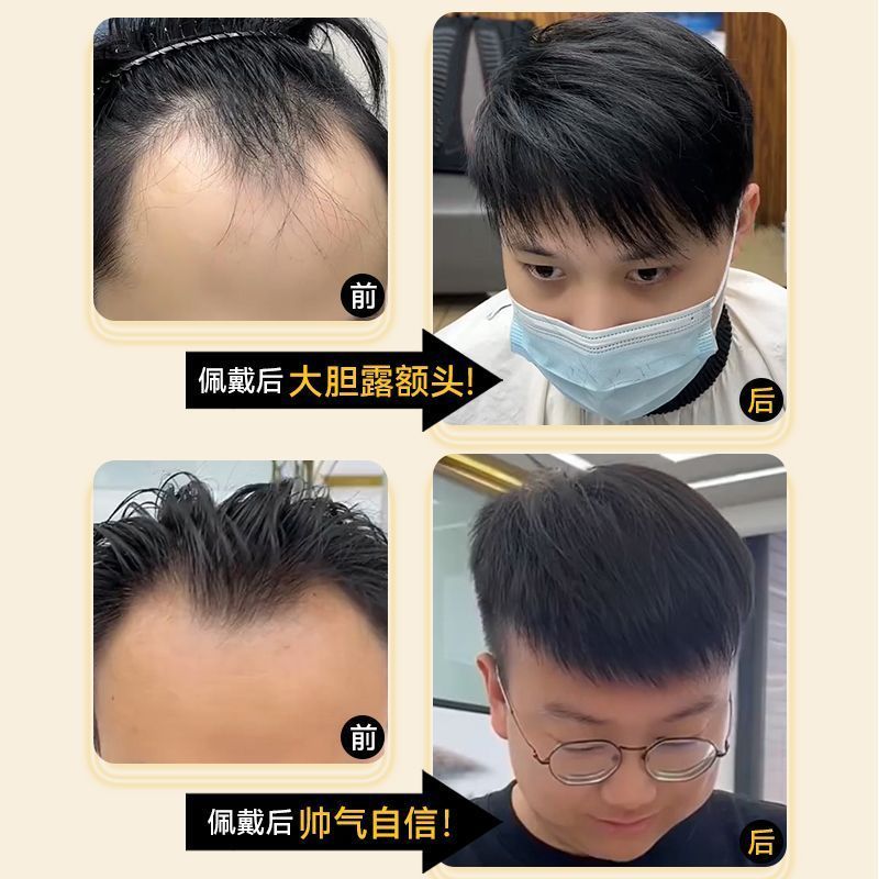 假发男生新款蓬松隐形刘海假发片发际线假发贴男前额无痕补发片全