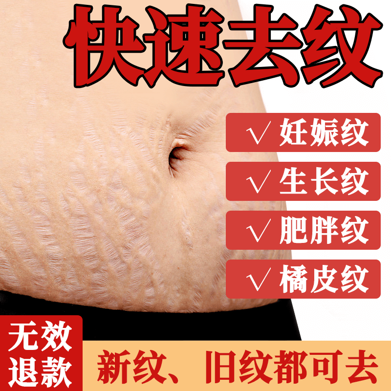 防妊娠纹去橄榄油孕妇妊娠纹油产后修复霜消除淡化预防专用护肤品