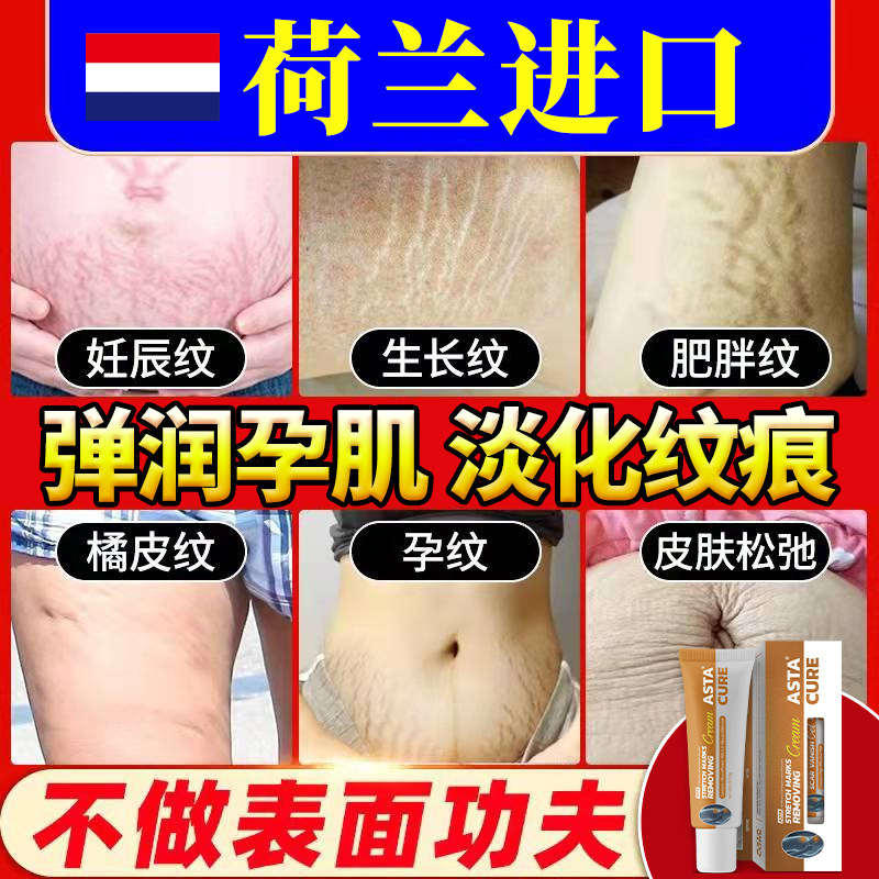 防妊娠纹去橄榄油孕妇妊娠纹油产后消除修复霜淡化预防专用护肤品