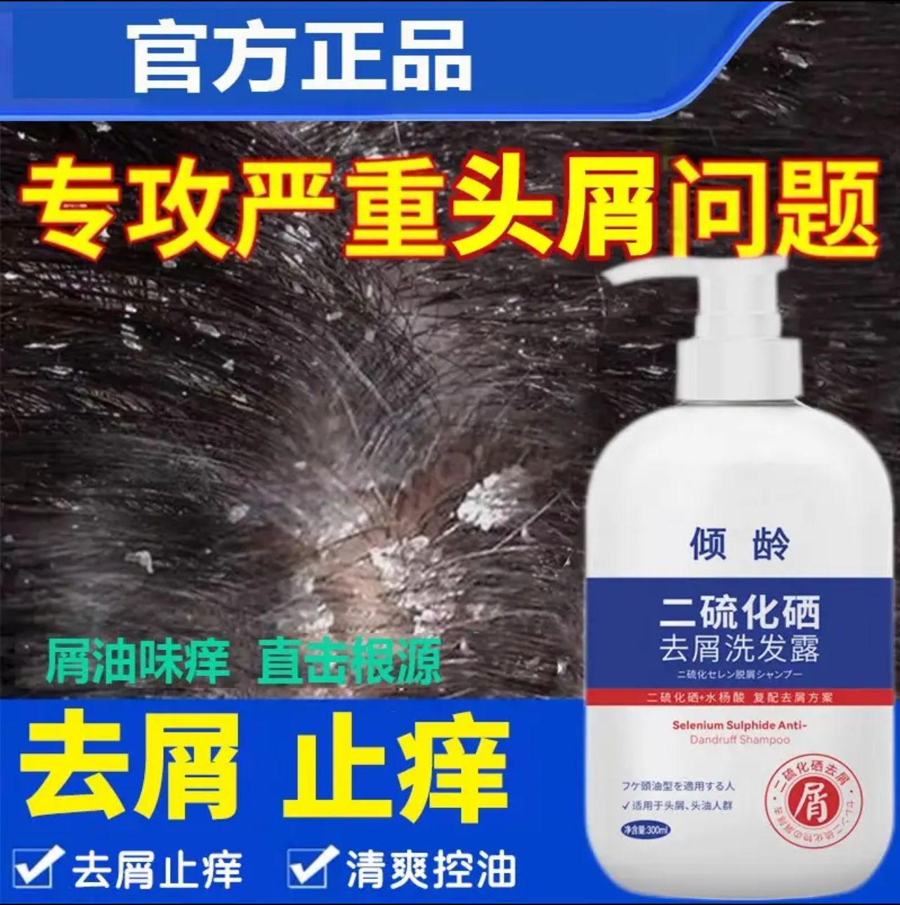 倾龄发露去屑止痒维稳