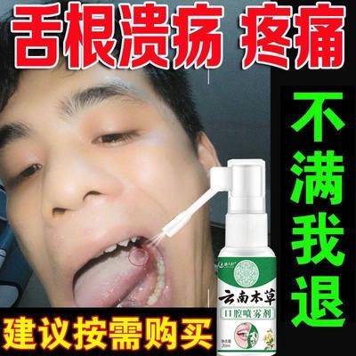 云南口腔溃疡专用喷剂凝胶特效神一点灵牙龈肿痛复发性口疮疼薬膏