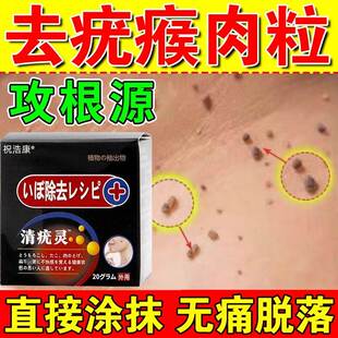 扁平疣去除药膏乳祛疣瘊子寻常尤脖子上长小肉粒一抹灵克疣膏正品