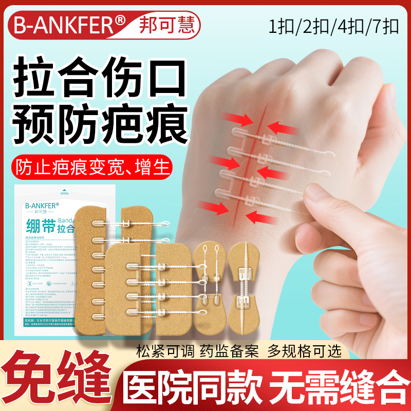 医用皮肤减张贴伤口刨腹免缝胶带