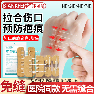 医用皮肤减张贴伤口刨腹免缝胶带