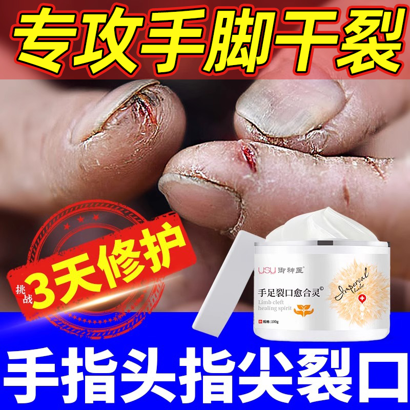 【药房直售】冬天手裂开药膏正品