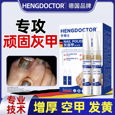 【胖东來爆款】德国灰指甲抑菌液