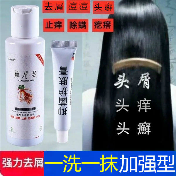 去毛囊炎的洗发水药膏头皮去屑止痒神器治背部疙瘩痘痘头癣洗发水