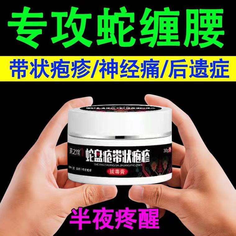 带状疱疹后遗症神经痛特效外用
