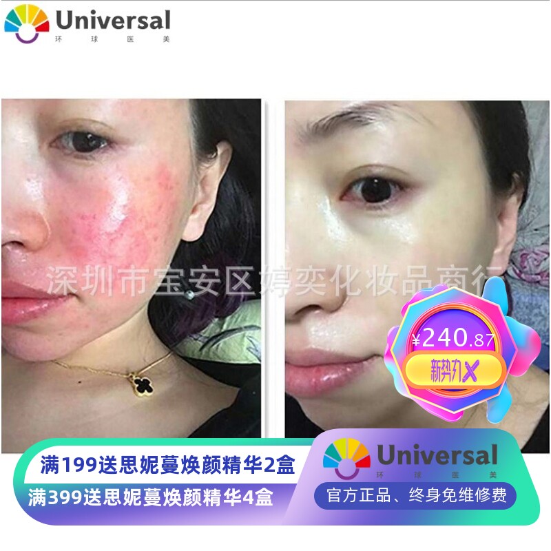 甘草修护退荭精华 液止干痒淡敏晒后修护褪红丝 化妆品美容院