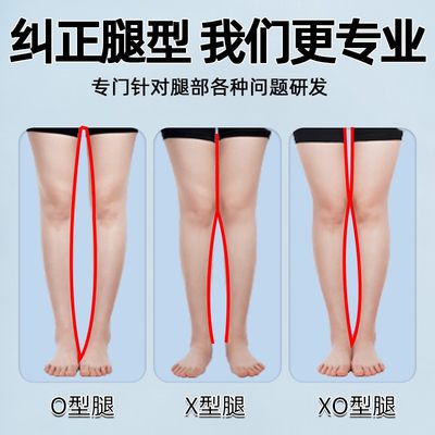 腿翻足字外八纠XO型正O型腿矫正成人腿翻直腿神器腿鞋垫小外外型