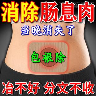 肠息肉克星特效药治疗肠梗阻肠息肉中成药贴肠道炎胆囊息肉特效药