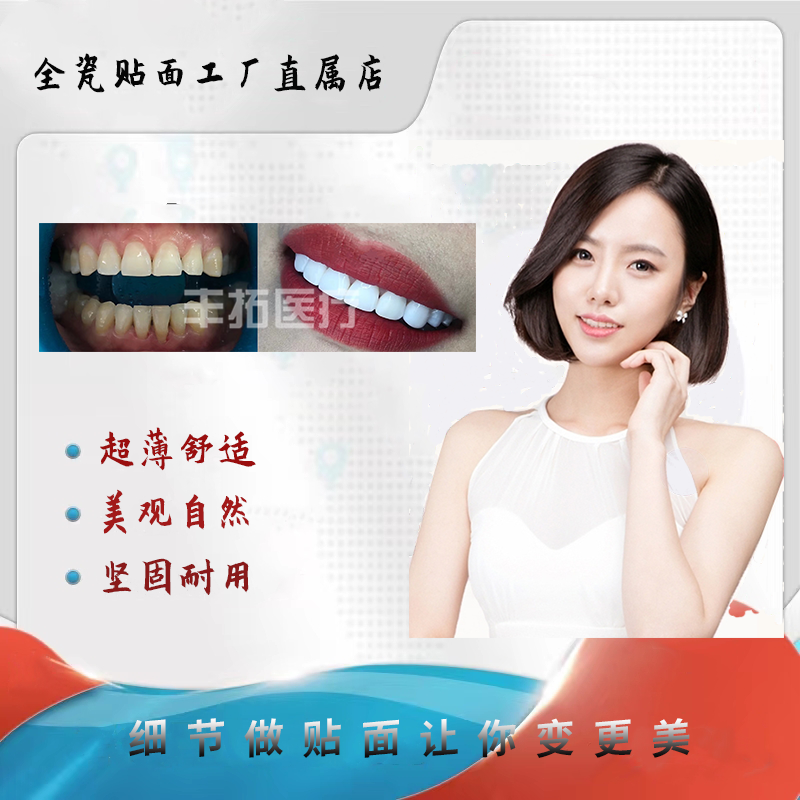 美加牙齿全瓷贴面美白大牙缝四环素黄黑牙专用美白贴面德国进口