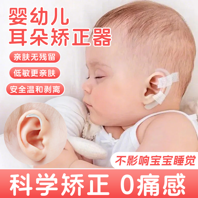 耳朵矫正器婴儿耳郭畸形垂耳招风