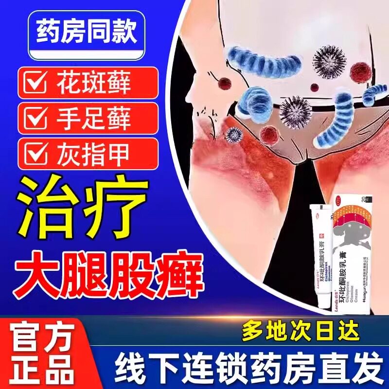 【今天发】环吡酮胺乳膏真菌感染体癣股癣手足癣特效花斑甲癣正品