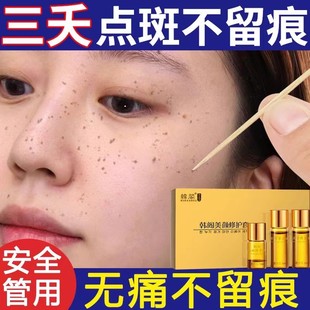 祛斑点痣点斑专用水精华液分解黑色素无痕正品黄褐斑雀斑老年斑