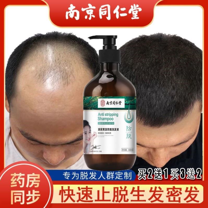 洗发水防脱发育发生发中药生姜何首乌养黑发洗发水自然黑同仁堂