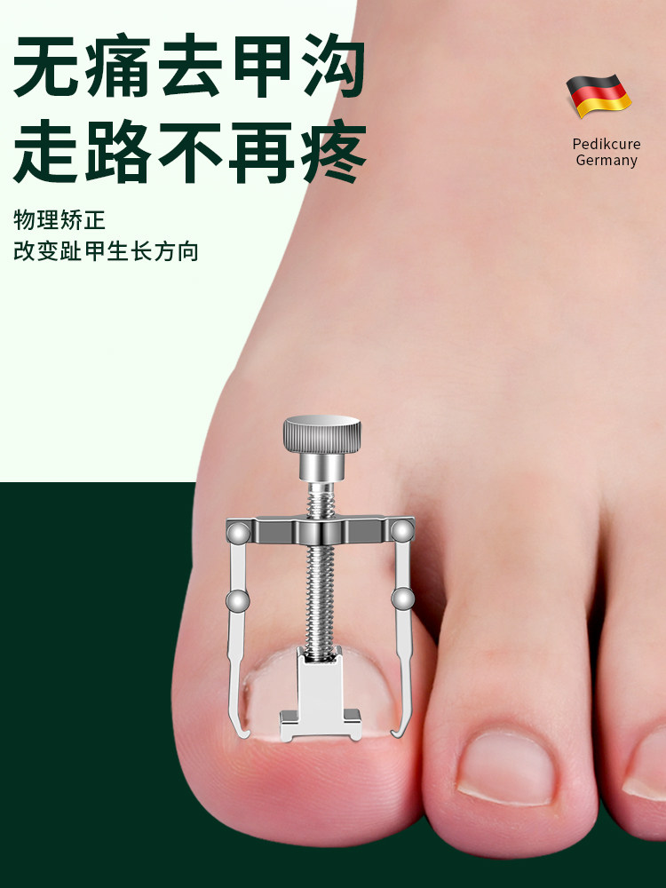 Painless Ingrown Toenail Treatment & Pedicure Kit - Product image 5