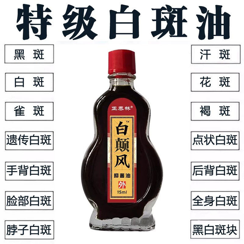 正泰林白癫风抑菌油手部