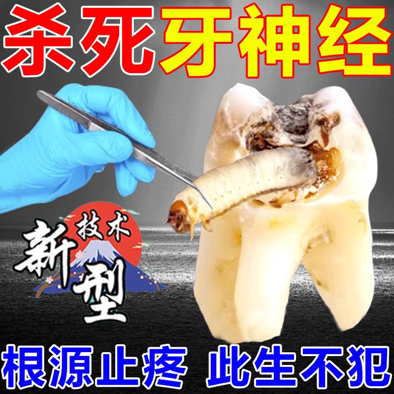 杀死牙神经去牙疼牙痛立可停专用口鼻清洁杀菌消炎剂