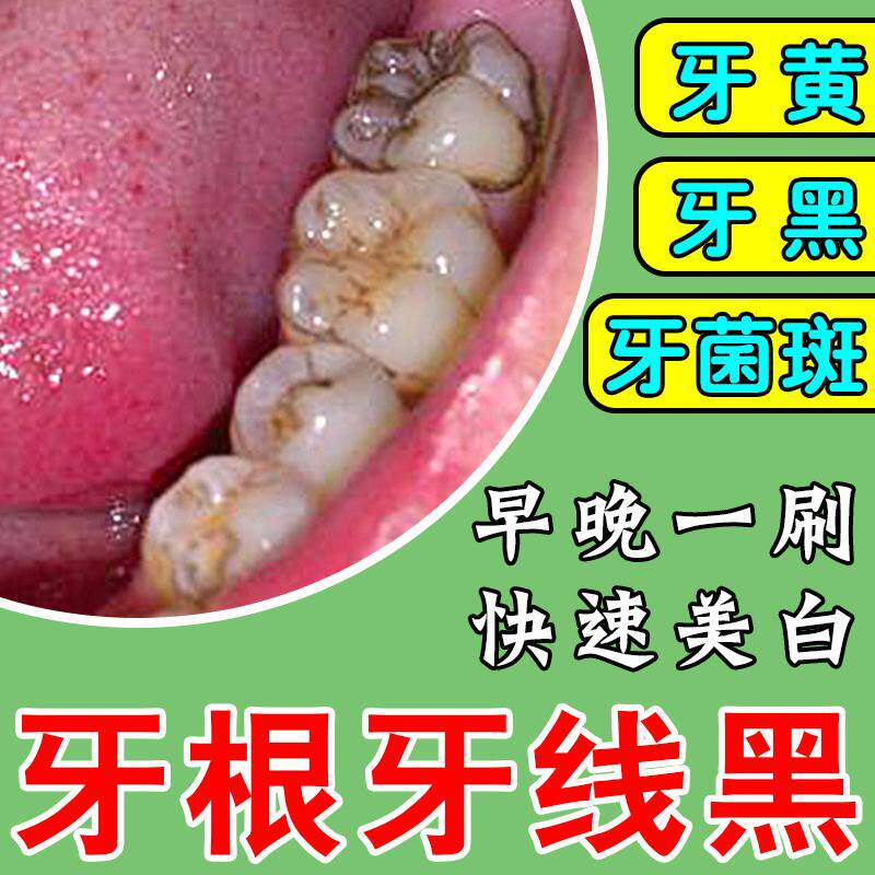牙齿缝隙黑牙根发黑益生菌牙膏儿童牙齿黑斑去除牙菌斑神器黄黑渍