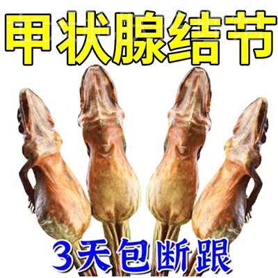 老中医秘方】节消散结贴专用甲亢贴消除淋巴肿大特效膏G