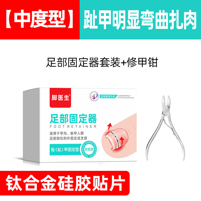 脚医生甲沟嵌甲指甲矫正器炎纠正脚沟趾甲长肉里专用胶水正甲贴片