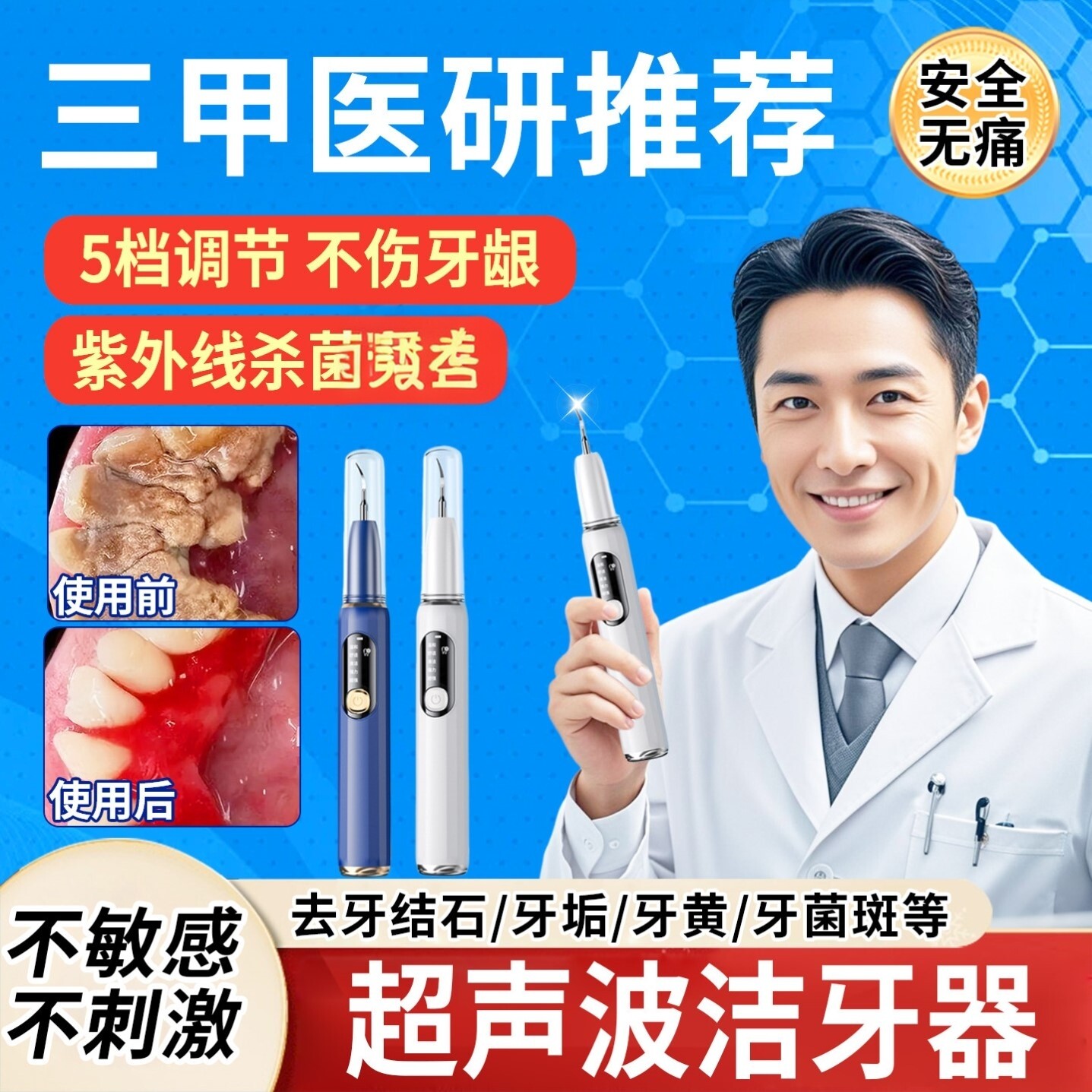 医用型超声波洁牙仪医院专用洗牙器除牙结石神器家用儿童清洁牙垢
