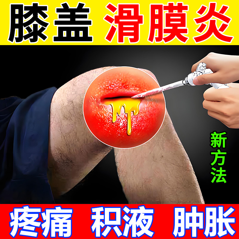 滑膜炎膝盖疼痛积水积液肿胀膏贴