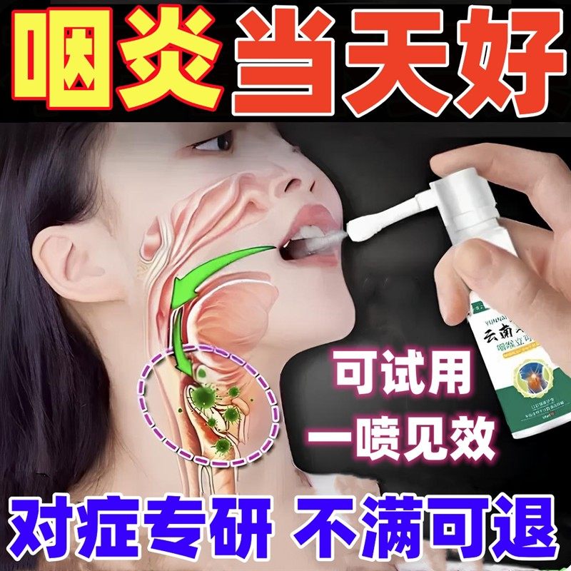 咽喉炎慢性咽炎除根贴治疗咙异物感痒滤泡增生润喉糖神器特效喷剂