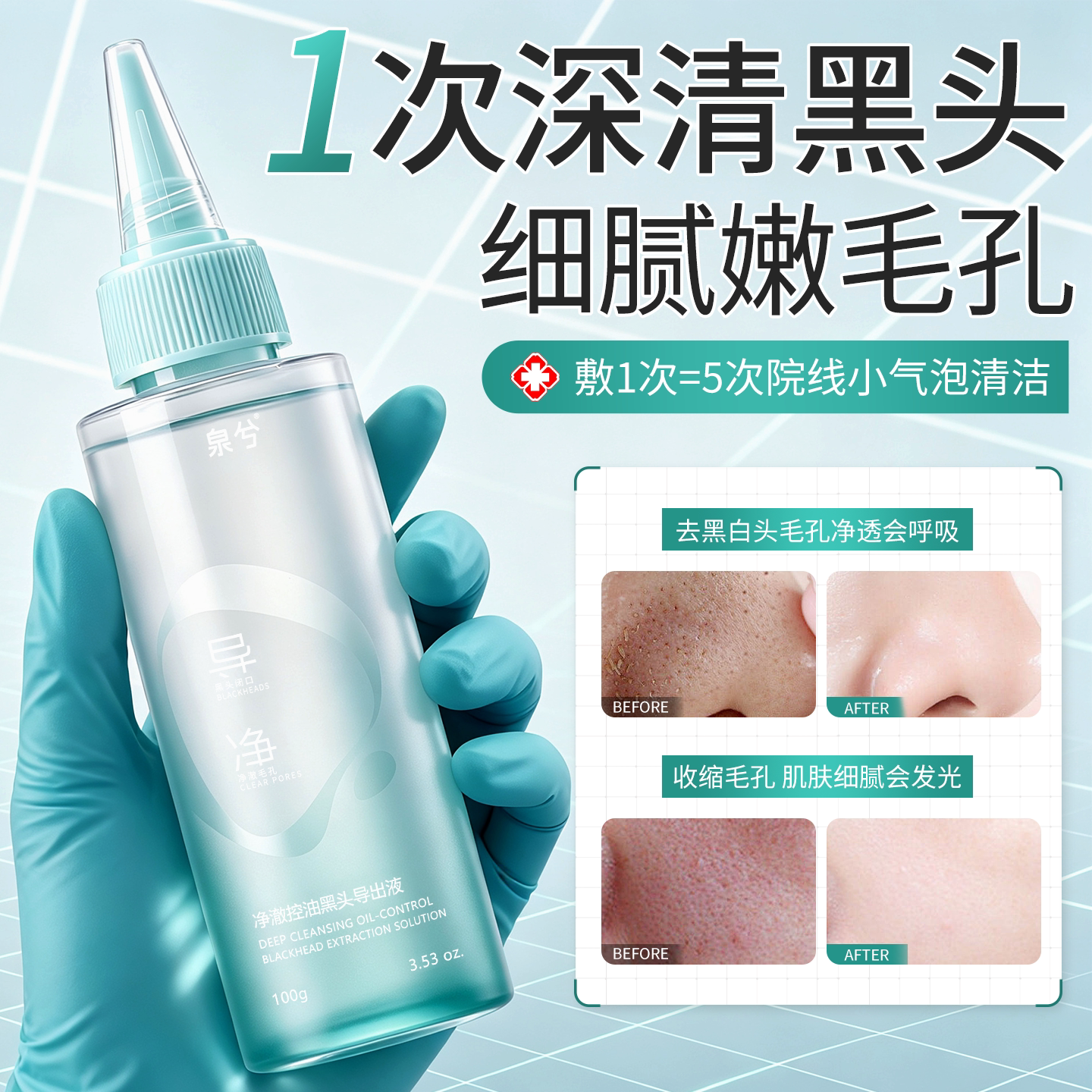 【全网热销100W】泉兮黑头导出液