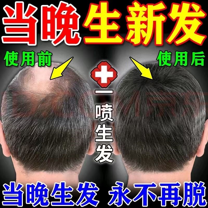 生发剂快速生长增发男女士专用防