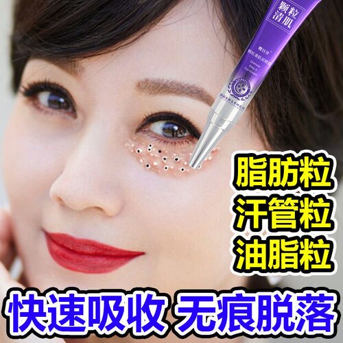 去脂肪粒汗管粒油脂粒去黑眼