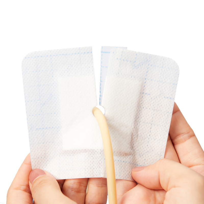 医用引流管导管固定贴无菌敷贴带孔腹透胆管肾穿刺造瘘尿管c型贴