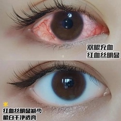 2021日本洗眼液清洁抗菌消炎止痒小j去红血丝补水眼部缓解林眼睛