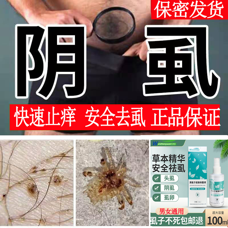 阴虱药男士用女私处去虱子药一扫光除虱卵净虱灵百部酊灭阴虱喷剂