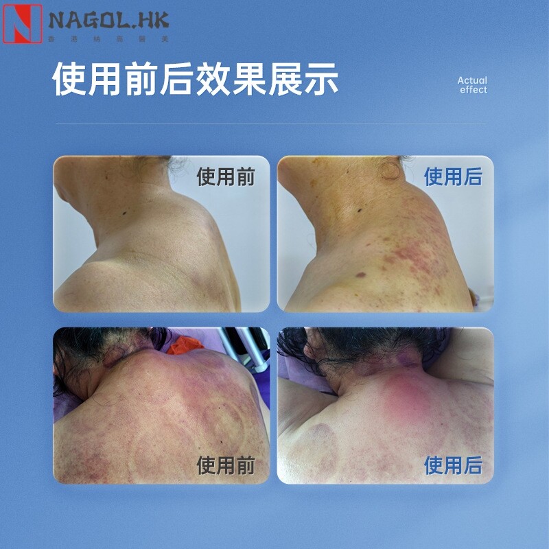 dds生物电疗仪美容院养生理疗精油全身按摩经络开背通热疗疏通