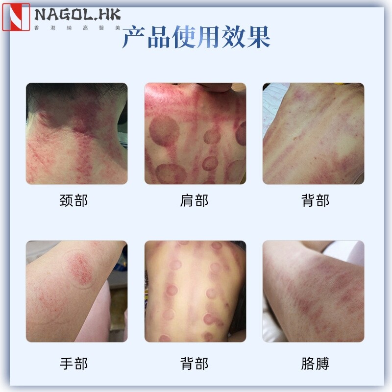 磁能筋疗养生仪器微电流疏通经络拨筋雕美容院刮痧拔罐身体调理仪